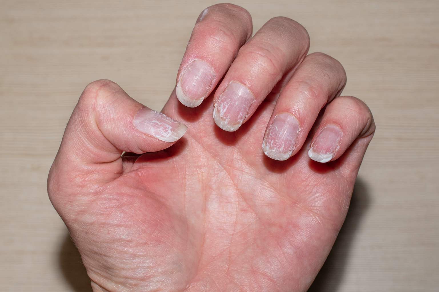 Nails feeling soft and brittle? how to repair them after gel or semi-permanent polish