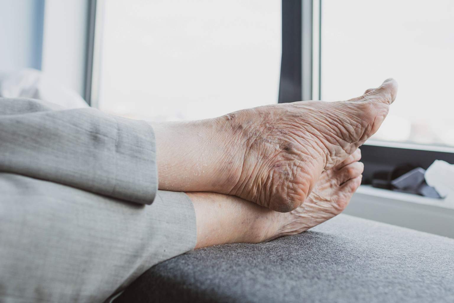 Neither slippers nor flip-flops: this type of clog is ideal for people over 65 at home