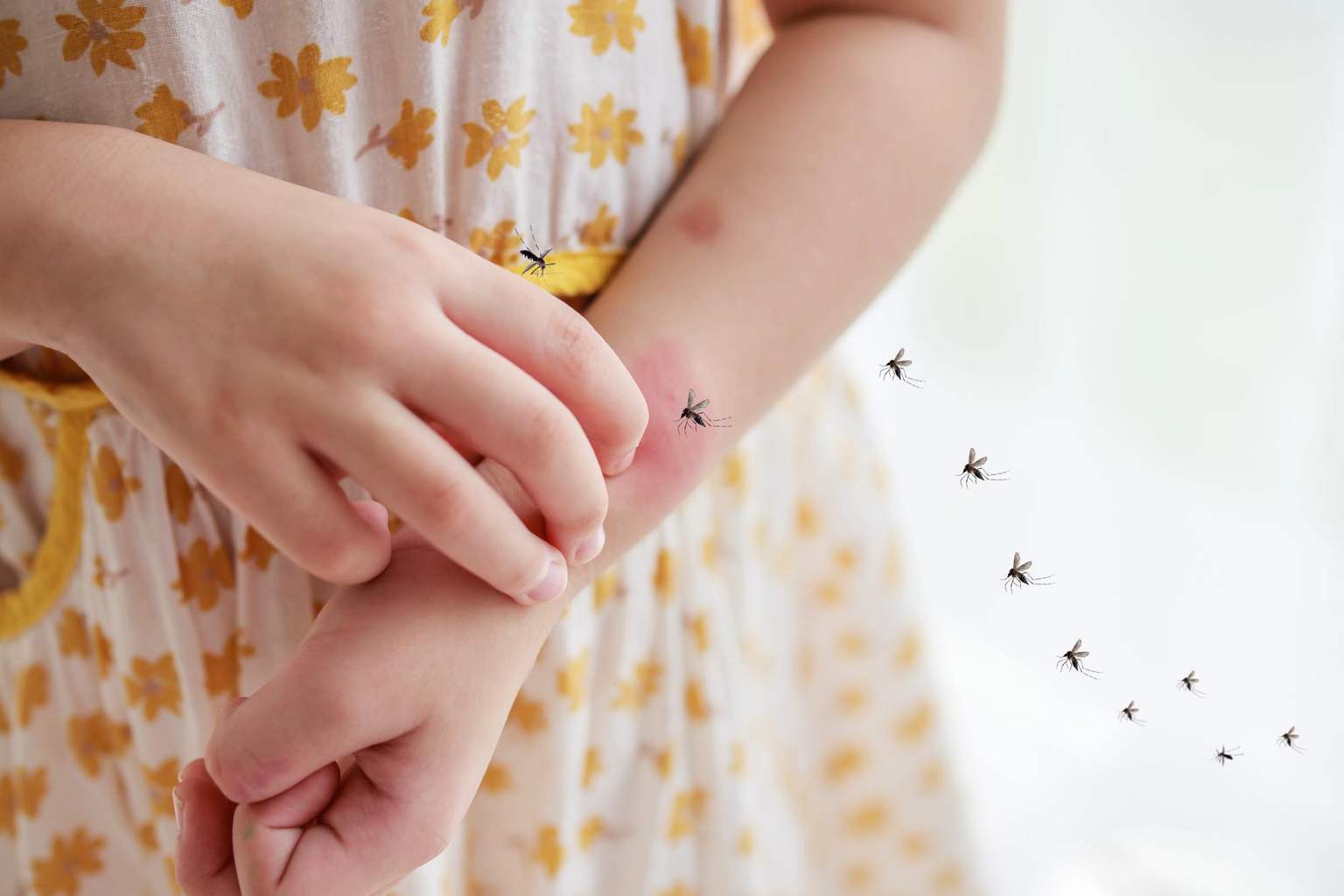 What to do after an insect bite? Natural remedies to soothe burning and itching sensations