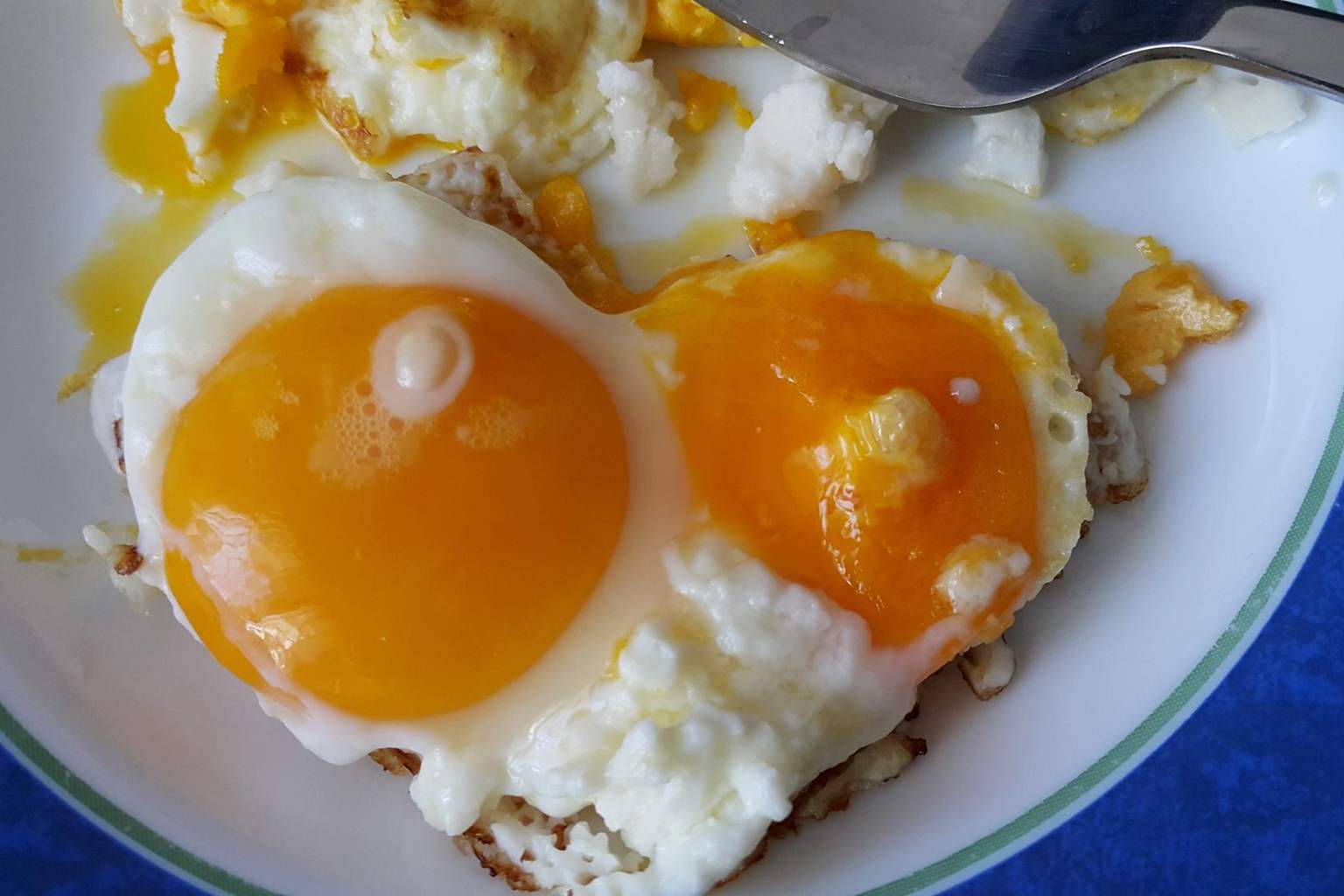 A cardiologist warns: this popular breakfast food is the main culprit of cholesterol
